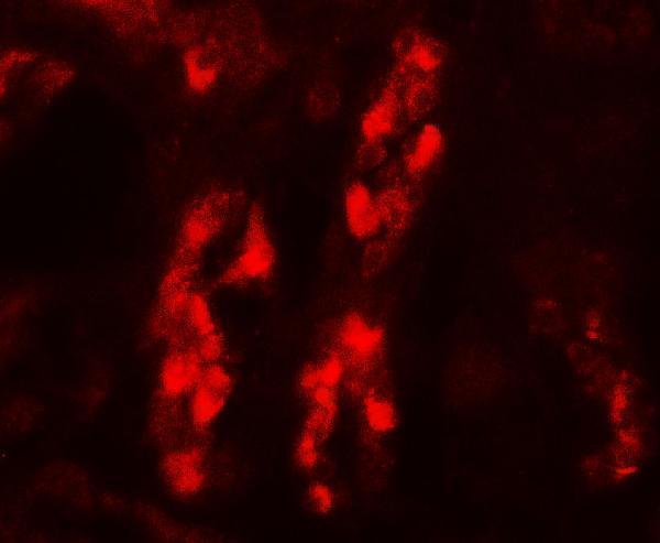 a10116 gdpd5 primary antibodies if testing 3