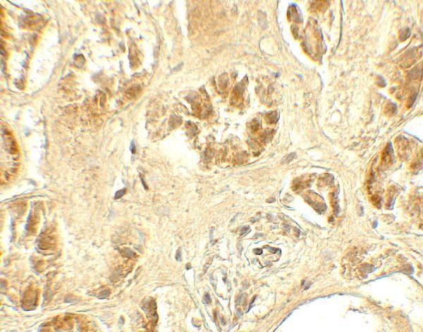 a10116 gdpd5 primary antibodies ihc testing 2