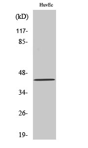 Western Blot analysis of various cells using HNK-1ST Polyclonal Antibody