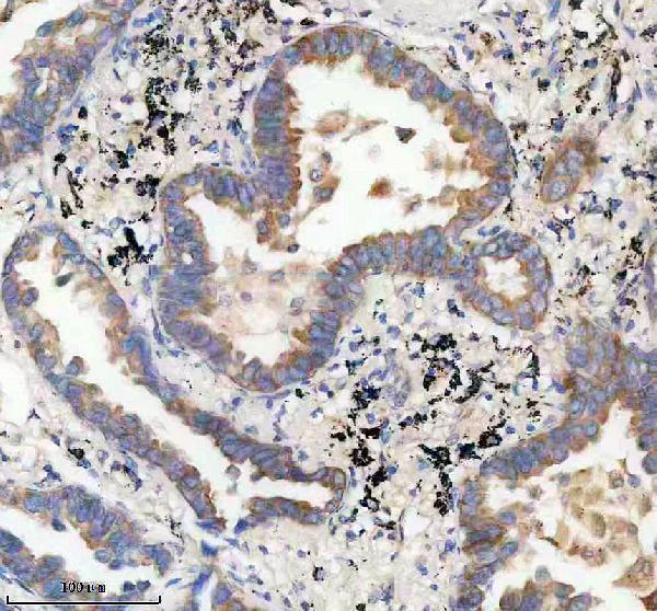 IHC analysis of PRR11 using anti-PRR11 antibody (A10121-1)
