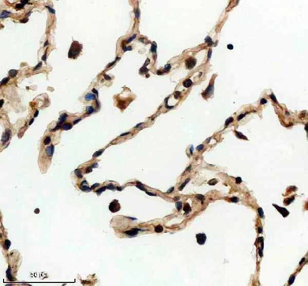 IHC analysis of PRR11 using anti-PRR11 antibody (A10121-1)