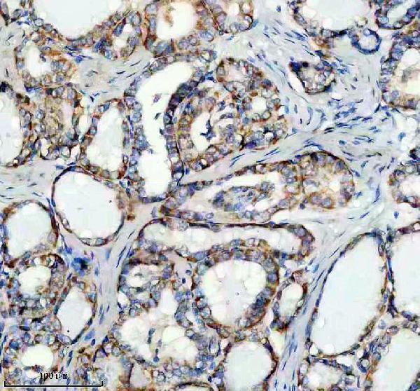 a10121 1 prr11 primary antibodies ihc testing 3