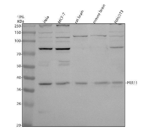 Western blot analysis of PRR11 using anti-PRR11 antibody (A10121-1)