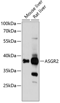 a10123 asgr2 primary antiboties wb testing 1