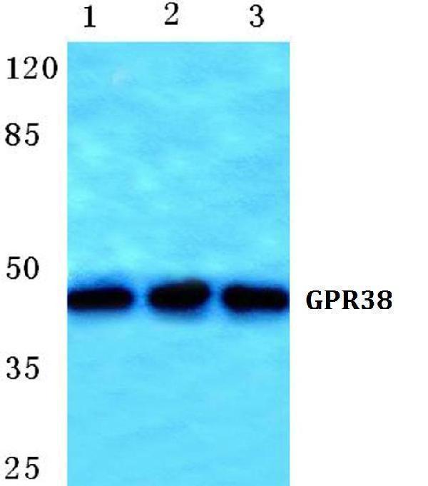 Western blot (WB) analysis of GPR38 polyclonal antibody at 1:500 dilution
Lane1:HEK293T cell lysate
Lane2:sp2/0 cell lysate
Lane3:NIH-3T3 cell lysate