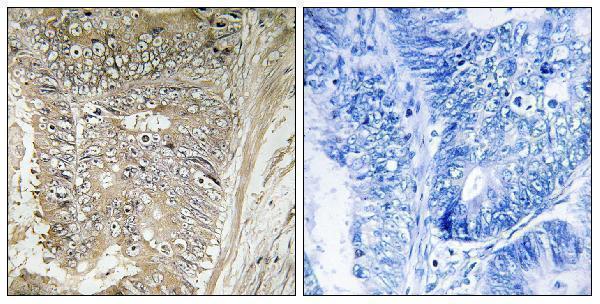 a10125 rpl37a primary antibodies ihc testing 1