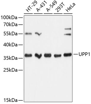 Western blot analysis of extracts of various cell lines, using UPP1 Antibody  at 1:3000 dilution