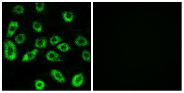 a10129 1 atp5d primary antibodies if testing 1
