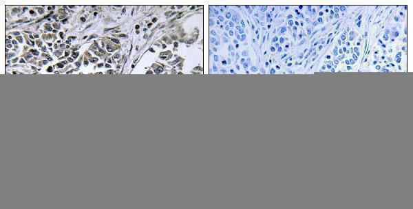 a10129 1 atp5d primary antibodies ihc testing 2