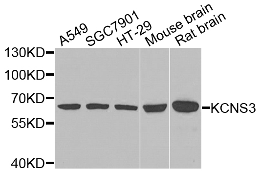 a10135 kcns3 primary antiboties wb testing 1