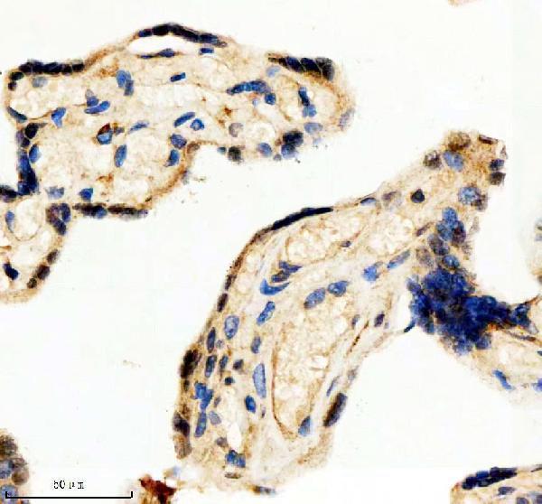 IHC analysis of SCAF11 using anti-SCAF11 antibody (A10138-1)