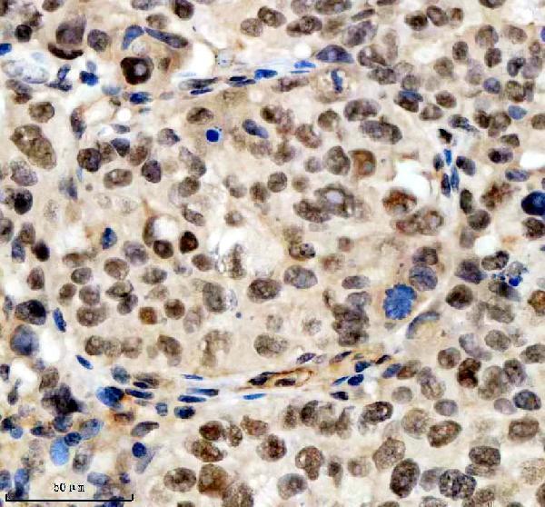 a10138 1 scaf11 primary antibodies ihc testing 10