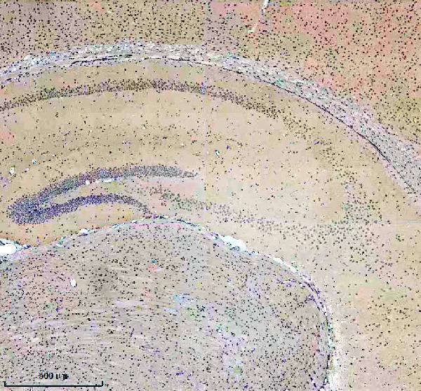 a10138 1 scaf11 primary antibodies ihc testing 11