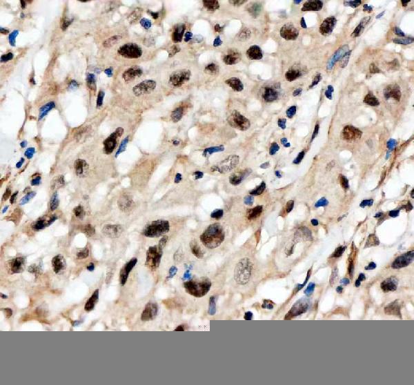 IHC analysis of SCAF11 using anti-SCAF11 antibody (A10138-1)