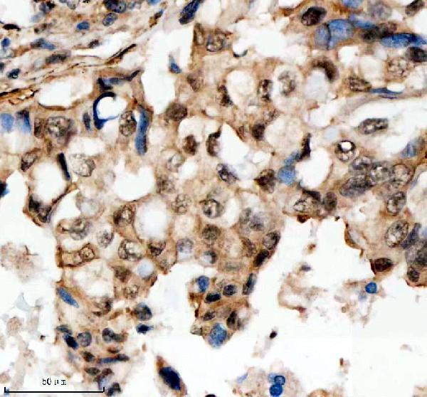 a10138 1 scaf11 primary antibodies ihc testing 3