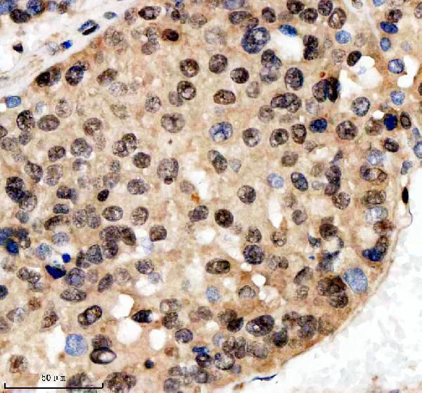 a10138 1 scaf11 primary antibodies ihc testing 4