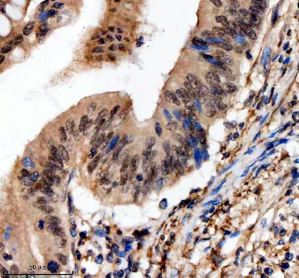 a10138 1 scaf11 primary antibodies ihc testing 5