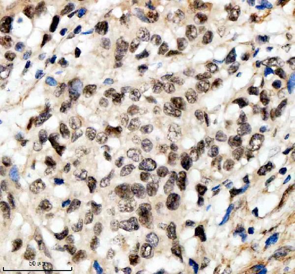 a10138 1 scaf11 primary antibodies ihc testing 9
