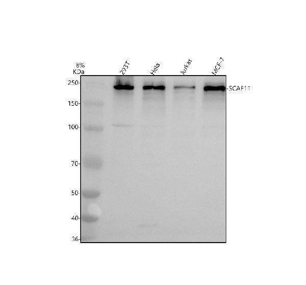 Western blot analysis of SCAF11 using anti-SCAF11 antibody (A10138-1)