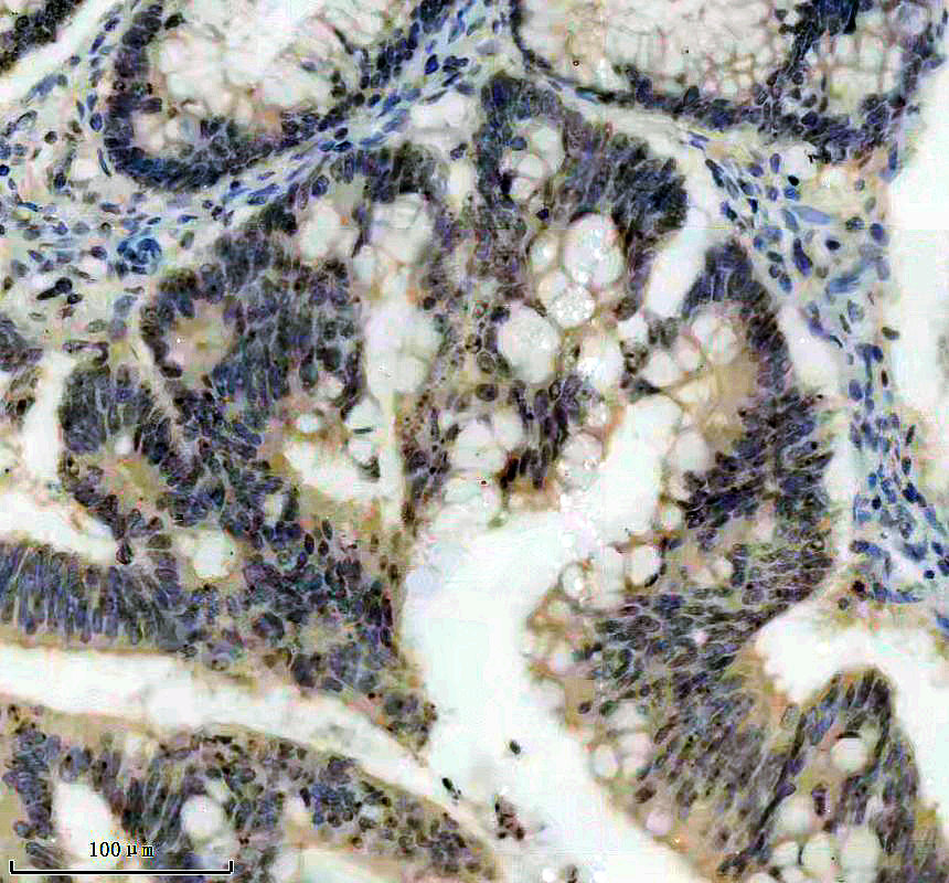 a10140 1 rrp9 primary antibodies ihc testing 1