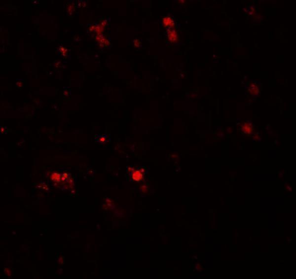 a10141 elovl7 primary antibodies if testing 3