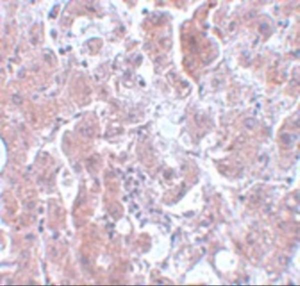 a10141 elovl7 primary antibodies ihc testing 2