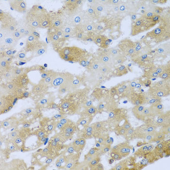 a10144 ap1m2 primary antiboties if testing 2