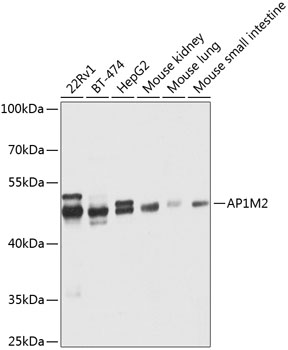 a10144 ap1m2 primary antiboties wb testing 1