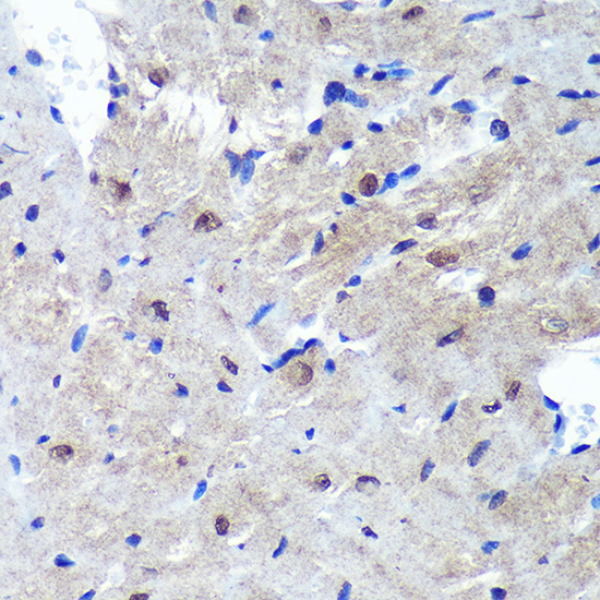 Immunohistochemistry of paraffin-embedded Mouse heart using PSME4 Rabbit pAb  at dilution of 1:100 