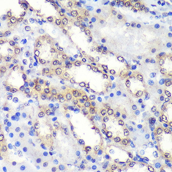 Immunohistochemistry of paraffin-embedded Rat kidney using PSME4 Rabbit pAb  at dilution of 1:100 