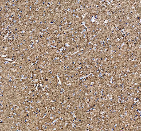 IHC analysis of SYNGR1 using anti-SYNGR1 antibody (A10148-1)