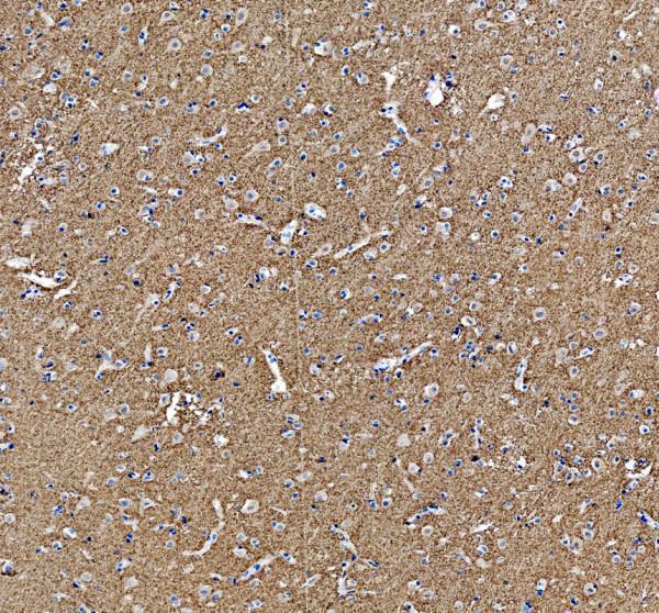 IHC analysis of SYNGR1 using anti-SYNGR1 antibody (A10148-1)