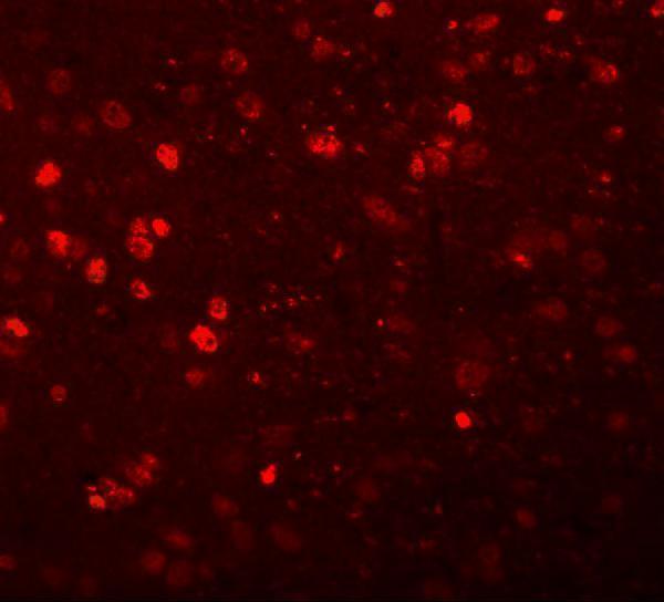 Immunofluorescence of SYNGR1 in rat brain tissue with SYNGR1 antibody at 20 μg/mL