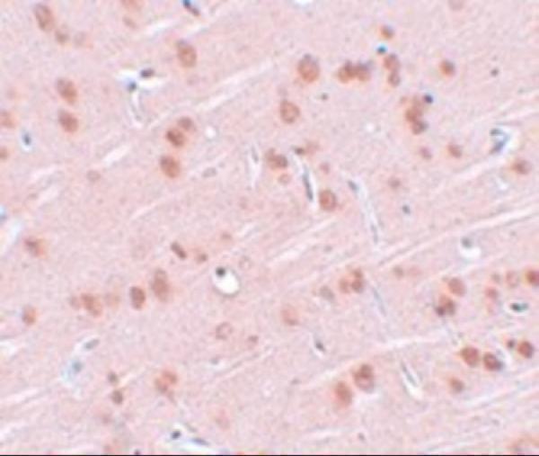 Immunohistochemistry of SYNGR1 in rat brain tissue with SYNGR1 antibody at 2