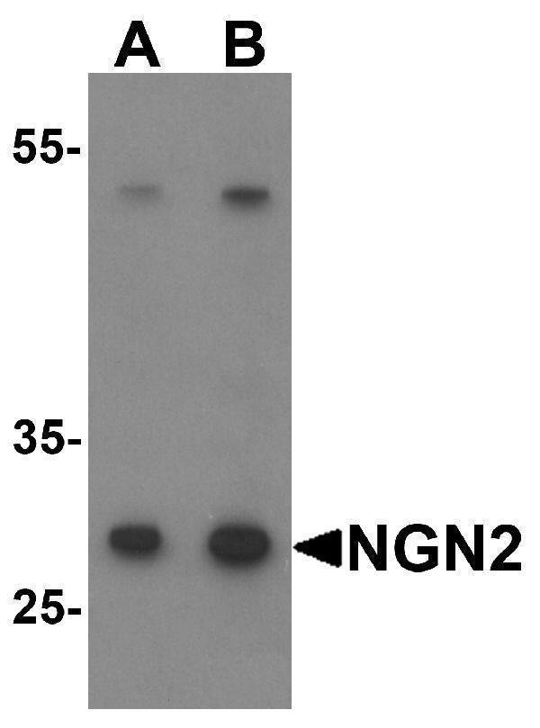 Western blot analysis of NGN2 in mouse small intestine tissue lysate with NGN2 antibody at (A) 1 and (B) 2 μg/mL