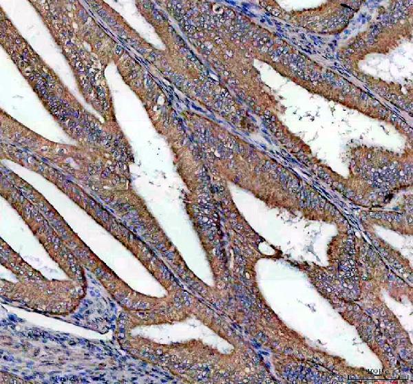 IHC analysis of EXOG using anti-EXOG antibody (A10155-2)