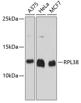 a10156 rpl38 primary antiboties wb testing 1