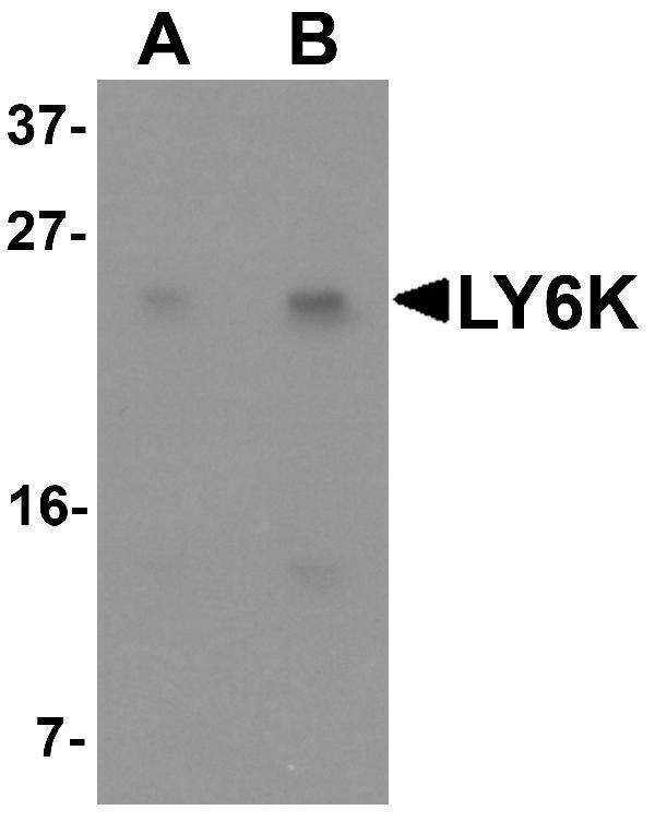 Western blot analysis of LY6K in HeLa cell lysate with LY6K antibody at (A) 1 and (B) 2 μg/mL