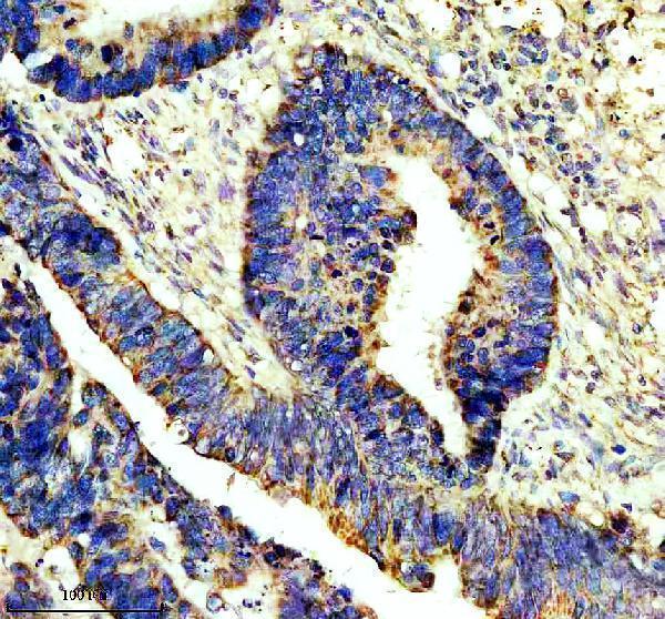 IHC analysis of AARS2 using anti-AARS2 antibody (A10160-2)