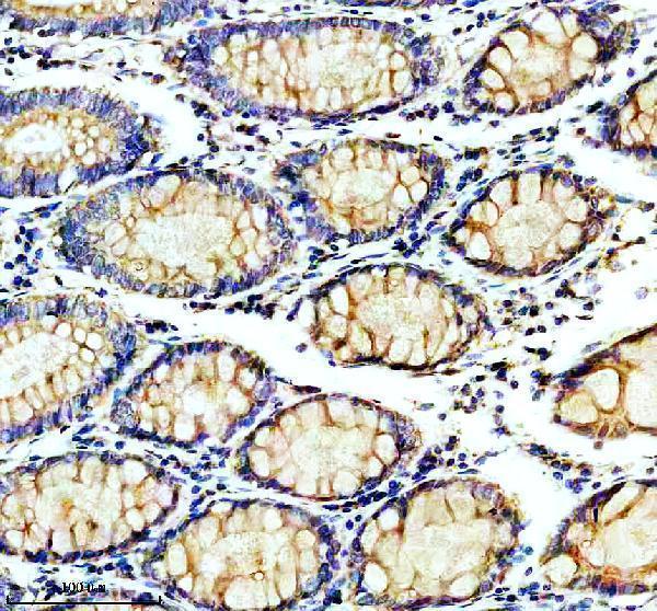 IHC analysis of AARS2 using anti-AARS2 antibody (A10160-2)