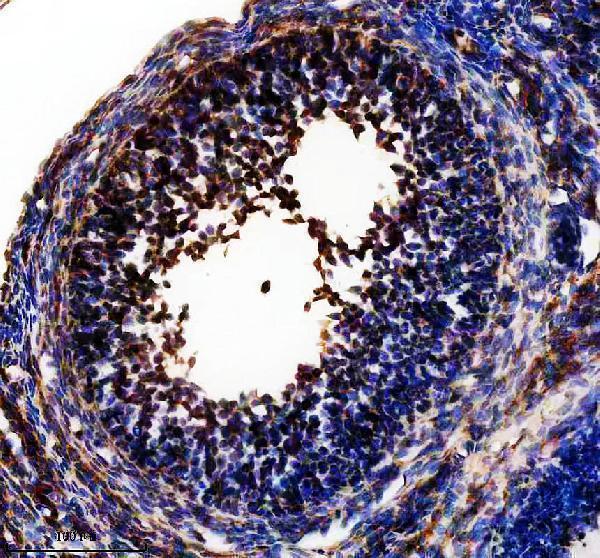 a10160 2 aars2 primary antibodies ihc testing 3