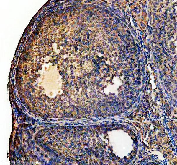 a10160 2 aars2 primary antibodies ihc testing 4
