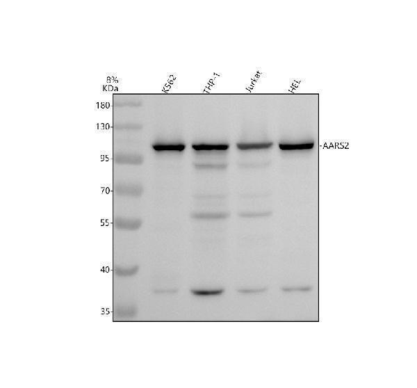 Western blot analysis of AARS2 using anti-AARS2 antibody (A10160-2)