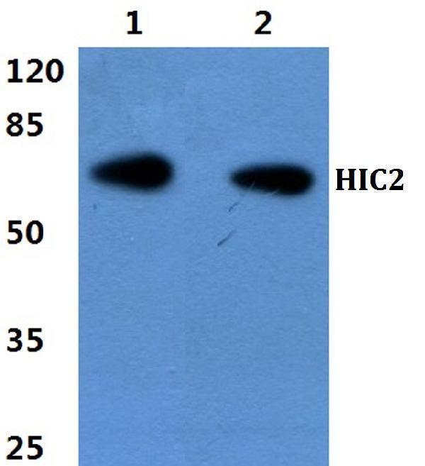 Western blot (WB) analysis of HIC2 polyclonal antibody at 1:500 dilution
Lane1:Hela cell lysate
Lane2:NIH-3T3 cell lysate