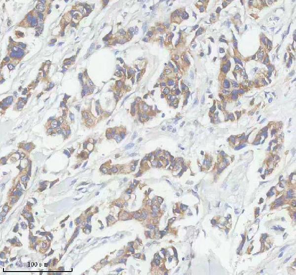 a10163 1 dhx34 primary antibodies ihc testing 1