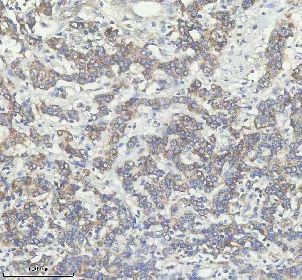 a10163 1 dhx34 primary antibodies ihc testing 2
