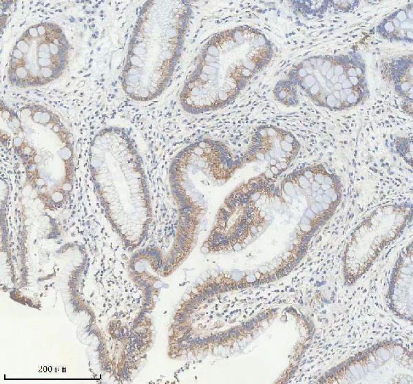 a10163 1 dhx34 primary antibodies ihc testing 3