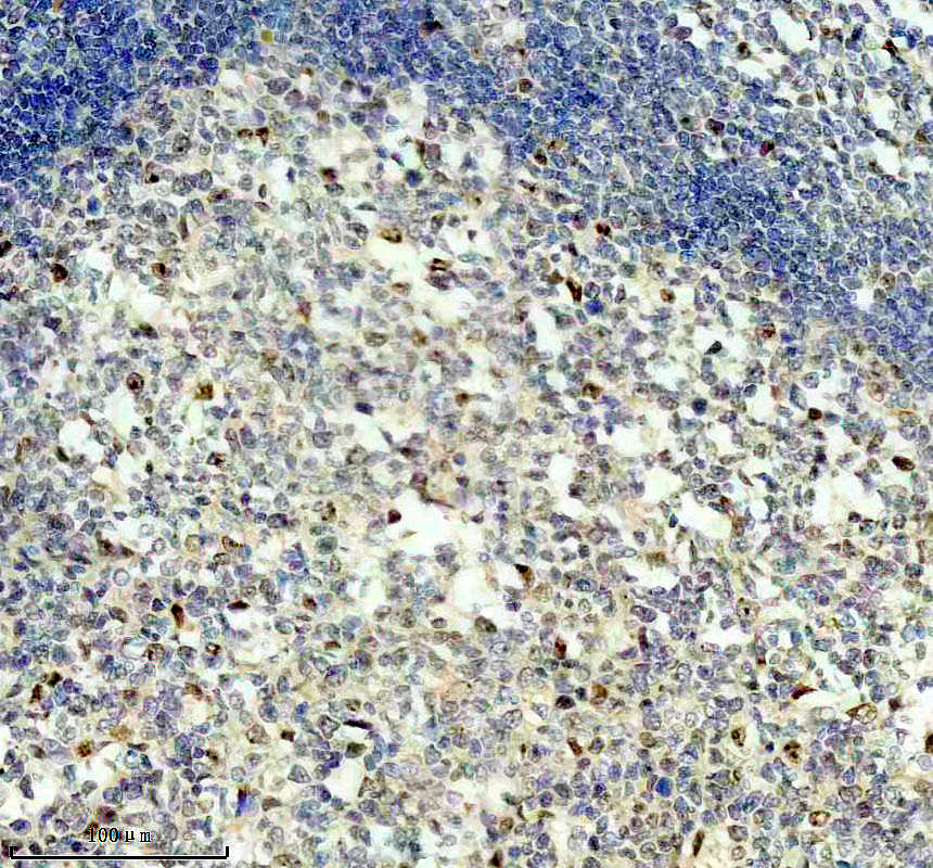 IHC analysis of NPM3 using anti-NPM3 antibody (A10166)