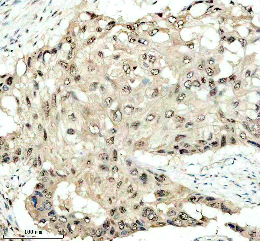 IHC analysis of NPM3 using anti-NPM3 antibody (A10166)