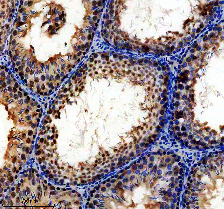a10166 npm3 primary antibodies ihc testing 3
